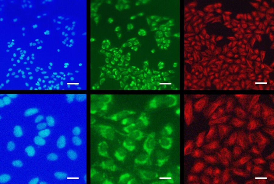 Figure 1: Resolution capability of the M205 FA fluorescence stereo microscope fitted on the UC Enuity. U2OS cells (human osteosarcoma cell line). Individual cells and even subcellular staining pattern of mitochondria and tubulin are visible. Magnification of 160x using the 0.63x objective. Upper row: overview. Scale bar 20 µm; lower row: Digitally cropped and zoomed images; nuclei stained in blue (Hoechst), mitochondria in green (Tom20) and tubulin in red (Atto 647). Scale bar 5 µm.