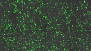 Transfection using the Uncommon Bio reprogramming system. Image acquired using the THUNDER Imager 3D Cell Culture with THUNDER Large Volume Computational Clearing (LVCC) applied. Image courtesy of Samuel East, Uncommon Bio. 