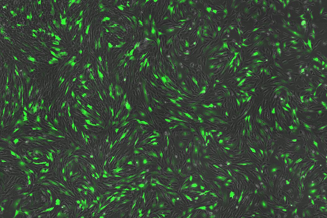 Transfection using the Uncommon Bio reprogramming system. Image acquired using the THUNDER Imager 3D Cell Culture with THUNDER Large Volume Computational Clearing (LVCC) applied. Image courtesy of Samuel East, Uncommon Bio.  Transfection_using_Uncommon_Bio_reprogramming_system.jpg