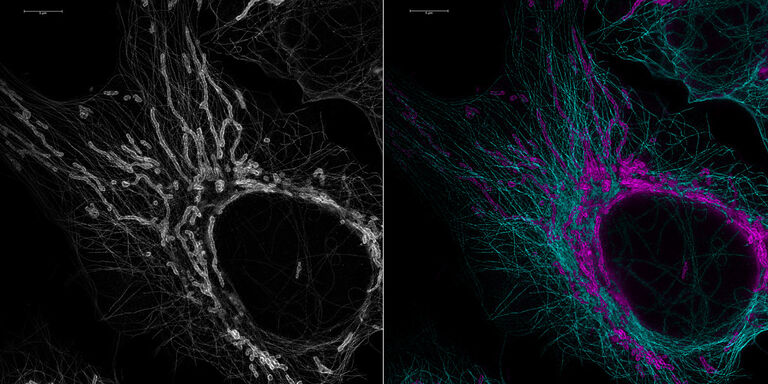 Séparation STED pour la biologie cellulaire : Le STED 775 et le module de séparation FALCON STED permettent de séparer des fluorochromes dont les spectres se chevauchent en utilisant leur temps de vie de fluorescence. Dans des cellules U2OS marquées pour TOM20 et la tubuline, les informations d'intensité du signal issues du comptage de photons (gris) montrent les deux structures comme indistinctes, tandis qu’elles sont nettement distinctes avec le STED-FLIM (cyan, AF647- tubuline ; magenta ATTO647N-TOM20). 