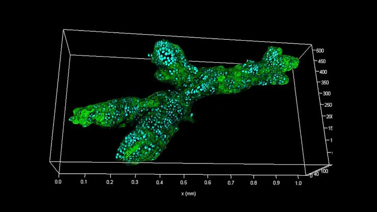 Branched organoid growing in collagen where the Nuclei are labeled blue. To detect the mechanosignaling process, the YAP1 is labeled green.