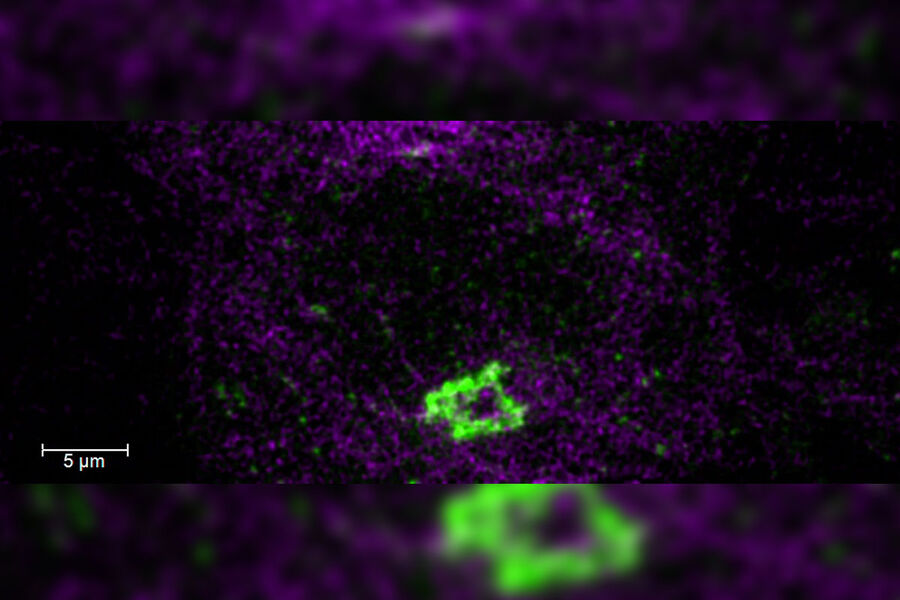 Células HeLa Kyoto. Por cortesía del Dr. Juan Jung, EMBL, Heidelberg, Alemania.