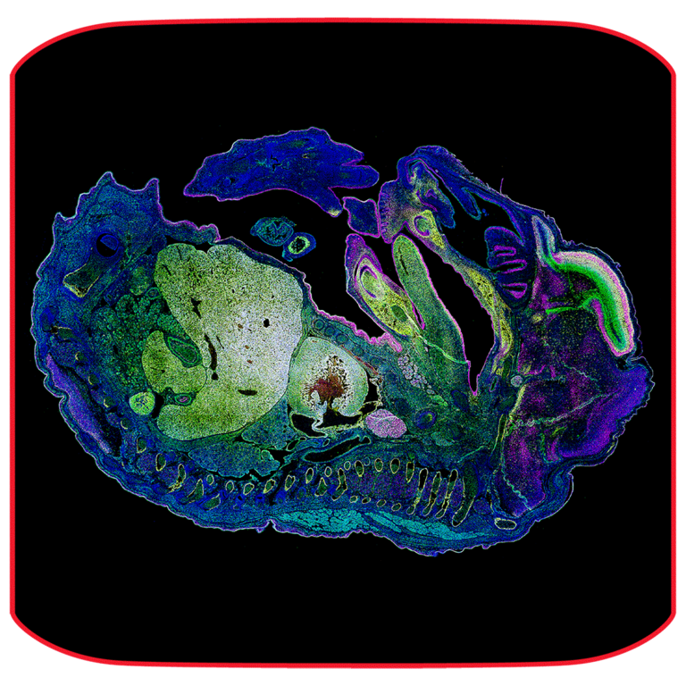 Coupe cryo d’embryon de souris (E15.5) capturée avec l’objectif PL APO 20x/0.75 CS2 . La coupe montre des cellules Tbr2 marquées avec CF488A, des cellules Satb2 marquées avec CF555 et des cellules Ctip2 avec CF633, ainsi que des noyaux contre-marqués avec DAPI. L’acquisition de deux coupes a pris moins de 5 minutes, alors qu’il fallait auparavant 2 heures sur l’appareil de comparaison du laboratoire. Échantillon et images avec l'aimable autorisation de Giulia Di Muzio au laboratoire du Dr Pei-Chi Wei au DKFZ, Heidelberg, Allemagne.