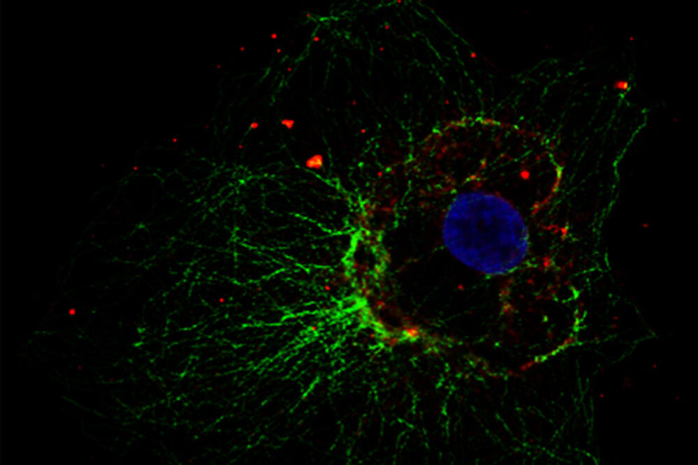 Zelluläres Mikrotubuli-Netzwerk in einer Fibroblastenzelle. lms-how-to-prepare-specimen-immunofluorescence-microscopy-sl-article-header.jpg