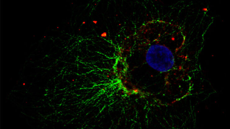 Cellular microtubule network in a fibroblast cell.