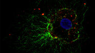 Cellular microtubule network in a fibroblast cell