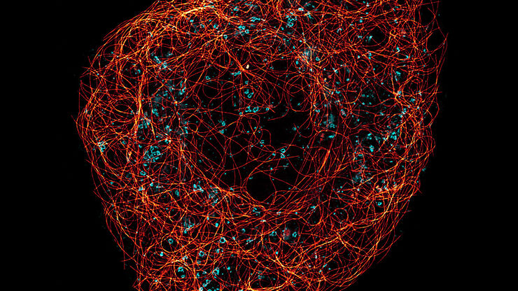 TauSTED 775 resolves the intricate cytoskeleton network labeled with SiR-tubulin (glow - Spyrochrome), and trafficking vesicles labeled with CF594 (cyan - Biotium). 