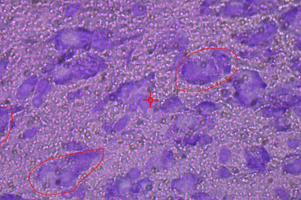 Image of murine dopaminergic neurons which have been marked for laser microdissection (LMD). Murine_dopaminergic_neurons_marked_for_LMD.jpg
