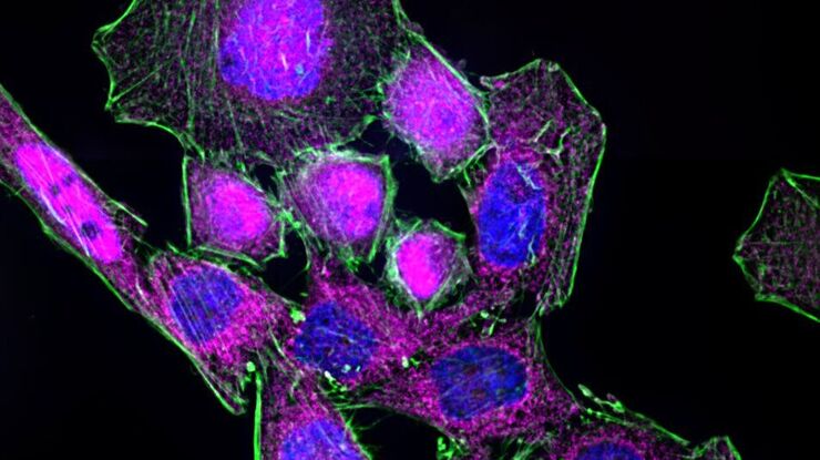 HeLa cells stimulated with LPS. Image has been subjected to deconvolution.