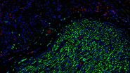 Fluorescence microscopy of sectioned tissue, showing the interface between the extensor digitorum longus muscle and the common peroneal nerve in the adult rat. Regenerative peripheral nerve interface (RPNI) at 2 weeks. Image acquired using Mica. Fluorescence microscopy of sectioned tissue, showing the interface between the extensor digitorum longus muscle and the common peroneal nerve in the adult rat. Regenerative peripheral nerve interface (RPNI) at 2 weeks. Image acquired using Mica. Stained for nuclei (blue), neurofilaments (green) and S100B (red). Image courtesy of Dr. Aaron Lee, Department of Bioengineering (Lab of Dr. Rylie Green), Imperial College London.