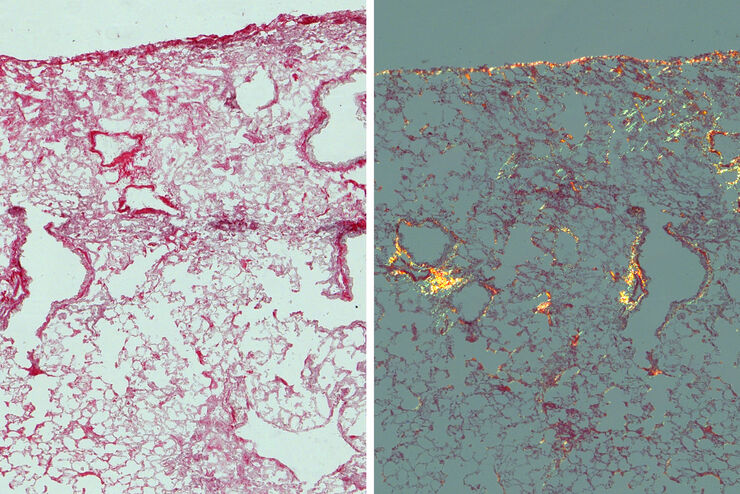 Mouse lung sections