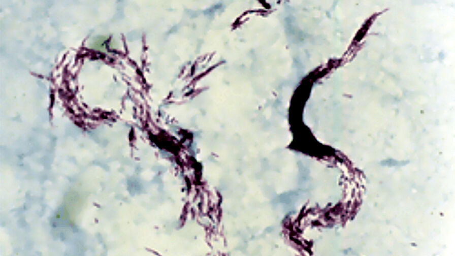 Mycobacterium causing tuberculosis