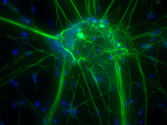 Neurones corticaux en culture (données brutes d'origine)