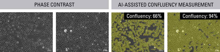 Fig. 1: Confluency values from manual assessment of conventional phase-contrast images of cell culture (left) and AI-assisted analysis (right).