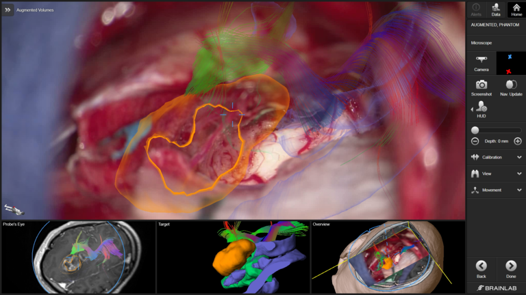 CaptiView with neuronavigation software Cranial 1.5 from Brainlab