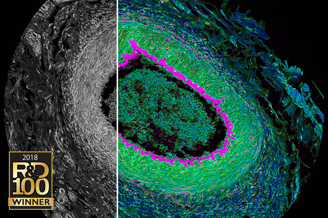 Secção histológica do olho do gato. A aquisição de imagens confocais espectrais simultâneas (cinza) e FLIM (cor) revela contraste por tempo de vida. Aquisição e visualização usando o SP8 FALCON e software LAS X.