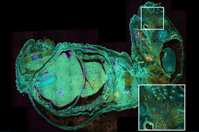 Straightforward acquisition of complex samples. High resolution mouse embryo mosaic image. Courtesy: Alexandra Just, Max Planck Institute for Biology of Aging, Cologne, Germany.