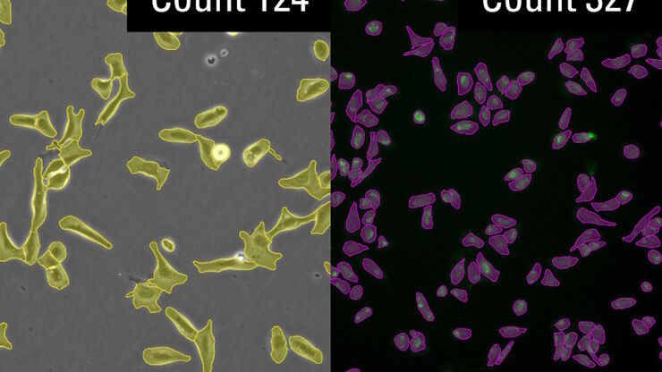 AI-based cell counting performed with a phase-contrast and fluorescence image using the Mateo FL microscope.