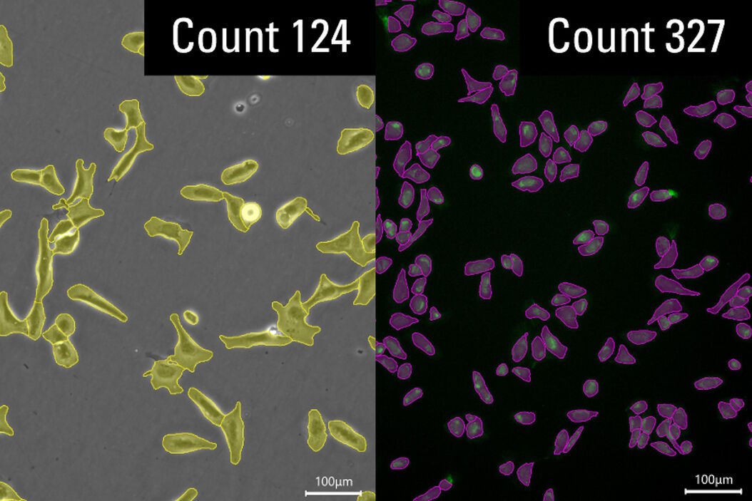 AI-based cell counting performed with a phase-contrast and fluorescence image using the Mateo FL microscope. AI-based_cell_counting_performed_with_phase-contrast_and_fluorescence_image.jpg
