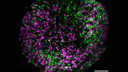 Brain organoid labeled with lamin (green) and tubulin (magenta), acquired using Viventis Deep. Courtesy of Akanksha Jain, Treutlein Lab ETH-DBSSE Basel (Switzerland). Brain organoid labeled with lamin (green) and tubulin (magenta), acquired using Viventis Deep. Courtesy of Akanksha Jain, Treutlein Lab ETH-DBSSE Basel (Switzerland).