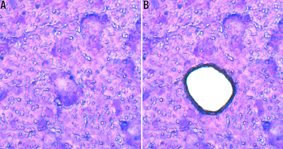Fig. 4: Cresyl-violet-stained mouse brain cryo-section before (A) and after (B) LMD [7]. 