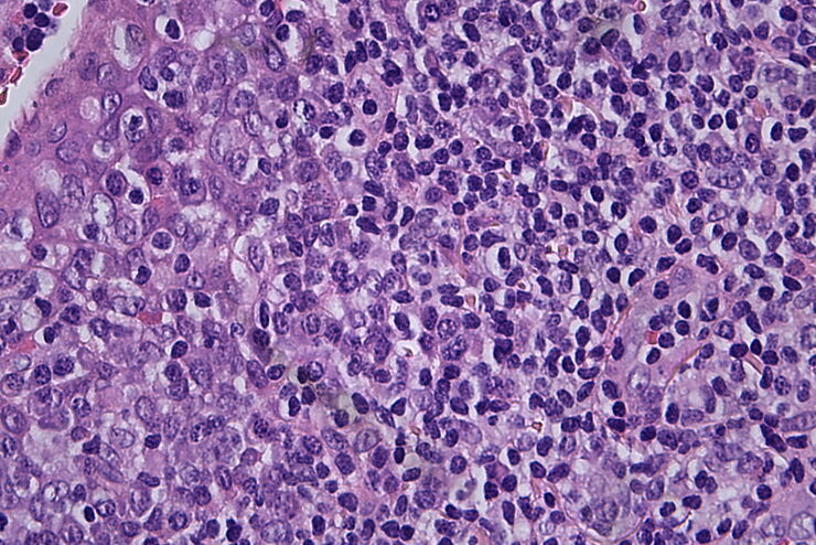 Histopathological sample, 40x magnification