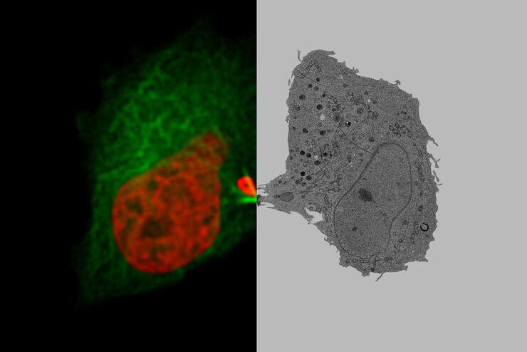 Image collage of a dividing HeLa cell. Left cell shows the fluorescent signals H2B-mCherry and alphaTubulin-mEGFP to visualize microtubules and DNA. The right image shows the corresponding cell, imaged in a transmission electron microscope. 