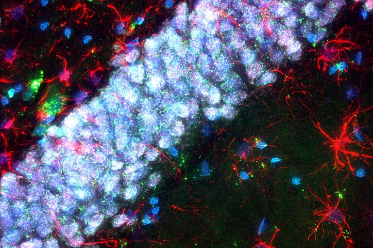 La figure montre une image THUNDER acquise avec la caméra CMOS scientifique K8 d’un cerveau de rat marqué avec du DAPI (bleu), de la fluorescéine STL (vert), du GFAP-Cy3 (rouge) et du NeuN Cy5 (gris). Échantillon fourni par FAN GmbH.