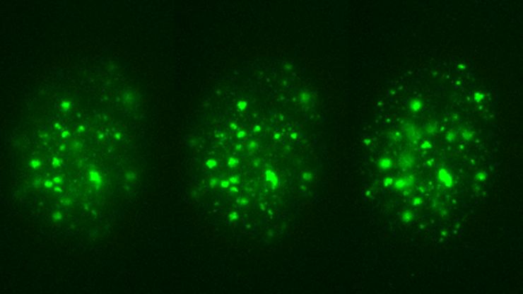 These images illustrate the need for multiple z-slices to capture all gH2Ax foci in a given cell and get an accurate count. These images illustrate the need for multiple z-slices to capture all gH2Ax foci in a given cell and get an accurate count.