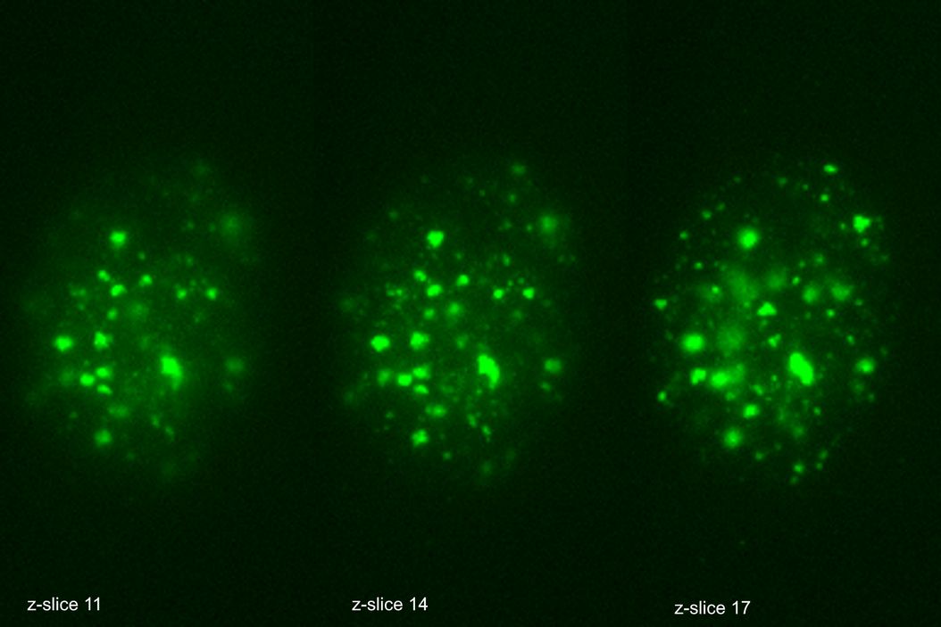 These images illustrate the need for multiple z-slices to capture all gH2Ax foci in a given cell and get an accurate count. These images illustrate the need for multiple z-slices to capture all gH2Ax foci in a given cell and get an accurate count. Multiple_Z_slices_to_capture_all_gH2Ax_foci.jpg