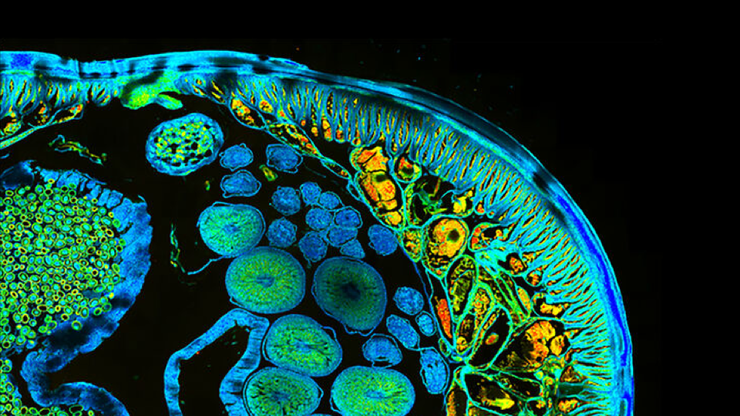 Roundworm – Imaging tasks become intuitive