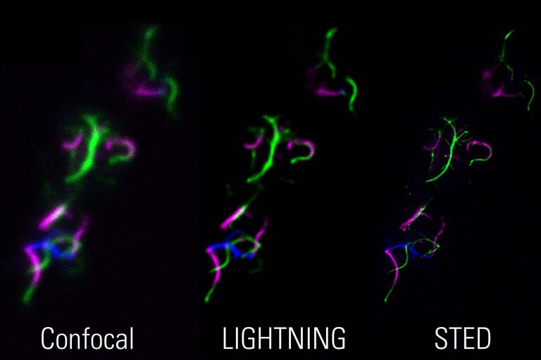 STED para microbiologia: Flagelos bacterianos visualizados com aquisição de imagens confocais correlativas de três cores -LIGHTNING-STED, o que permite a investigação e validação de amostras usando abordagens complementares. Amostra de cortesia de Marc Erhardt, da Universidade Humboldt, Berlim, na Alemanha.