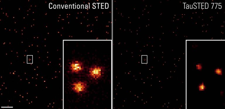 STED による DNA origamiのイメージング：TauSTED 775 は、公称サイズが 23 nm の GATTA-Bead R において、30 nm 以下の分解能を実現します。スケールバー: 1 µm。