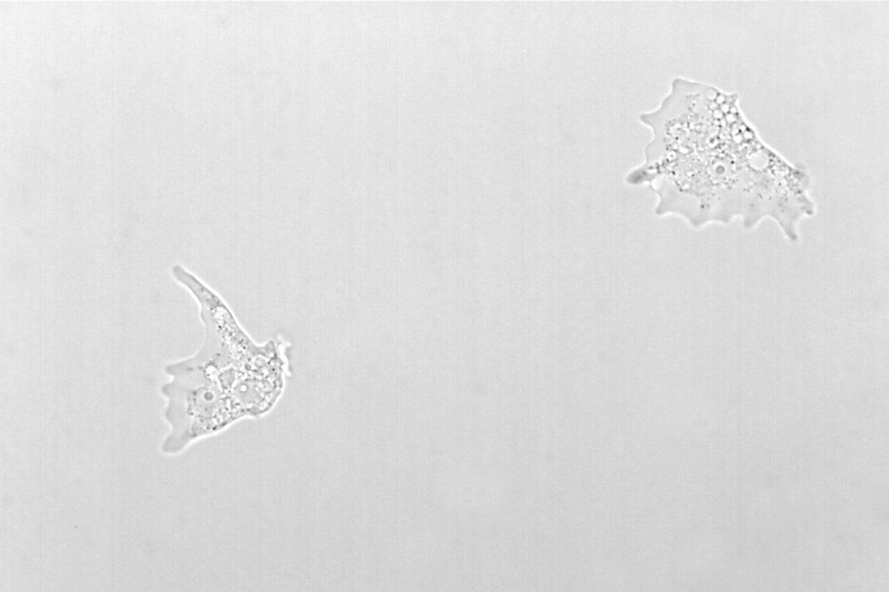 Abbildung 2: Bilder von Amoeba proteus, einem einzelligen Organismus, aufgenommen mit Phasenkontrast und Hellfeld.