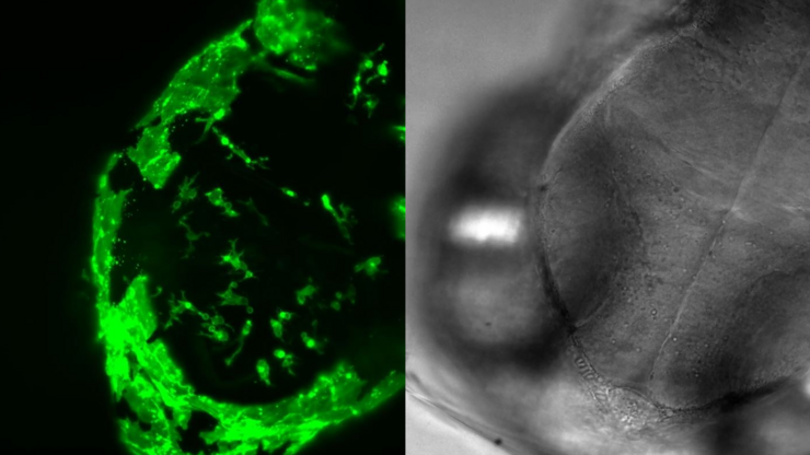 5 hour time-lapse maximum intensity projection of a zebrafish embryo along the z-axis at 3 days post fertilization. Left: microglia cells. Right: bright field channel. Courtesy of Prof. Francesca Peri, University of Zurich, Switzerland. 5 hour time-lapse maximum intensity projection of a zebrafish embryo along the z-axis at 3 days post fertilization. Left: microglia cells. Right: bright field channel. Courtesy of Prof. Francesca Peri, University of Zurich, Switzerland.