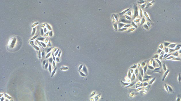 [Translate to italian:] Microscope image of cultured cells at the bottom of a dish.