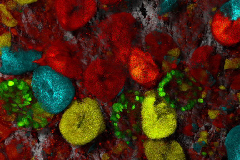 Intestino tenue di un topo Confetti: Il collagene1 è mostrato in grigio (SHG senza marcatura) e le cellule staminali tracciate per linea cellulare sono mostrate in ciano, verde, giallo e rosso. Le cellule staminali svolgono un ruolo importante nella diffusione del cancro all'interno degli organismi. Campione per gentile concessione di Jacco van Rheenen, Netherlands Cancer Institute, Paesi Bassi.