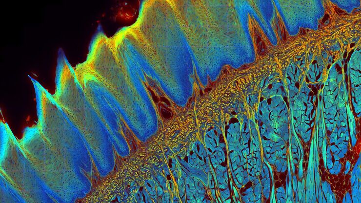 [Translate to spanish:] Transverse histological cut of a rabbit tongue. 50 Mpixels images (2326 µm x 1739 µm) in 14 x 18 tiles. Lifetime gives an additional contrast that allows to differentiate different structures in histological stainings.