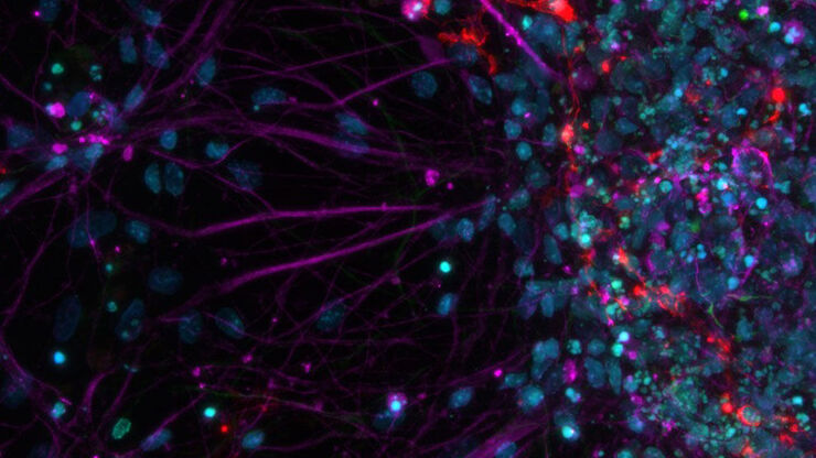 Primary cell culture from rat; Cy5 (magenta): Beta-III tubulin; Rhod (red): NG2 protein, GFP (green): Nestin protein; and DAPI (blue): nuclei.