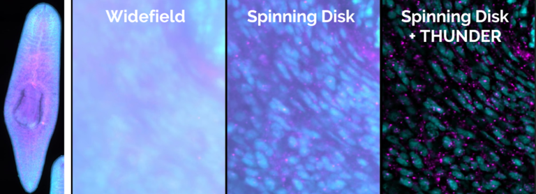 200 µm thick Planaria (flat worm) stained with DAPI (cyan) and mRNA FISH staining (magenta). Sample courtesy of Shuchang Hu, Developmental Biology Unit, Hanh Vu’s Group, European Molecular Biology Laboratory (EMBL), Heidelberg. Germany.