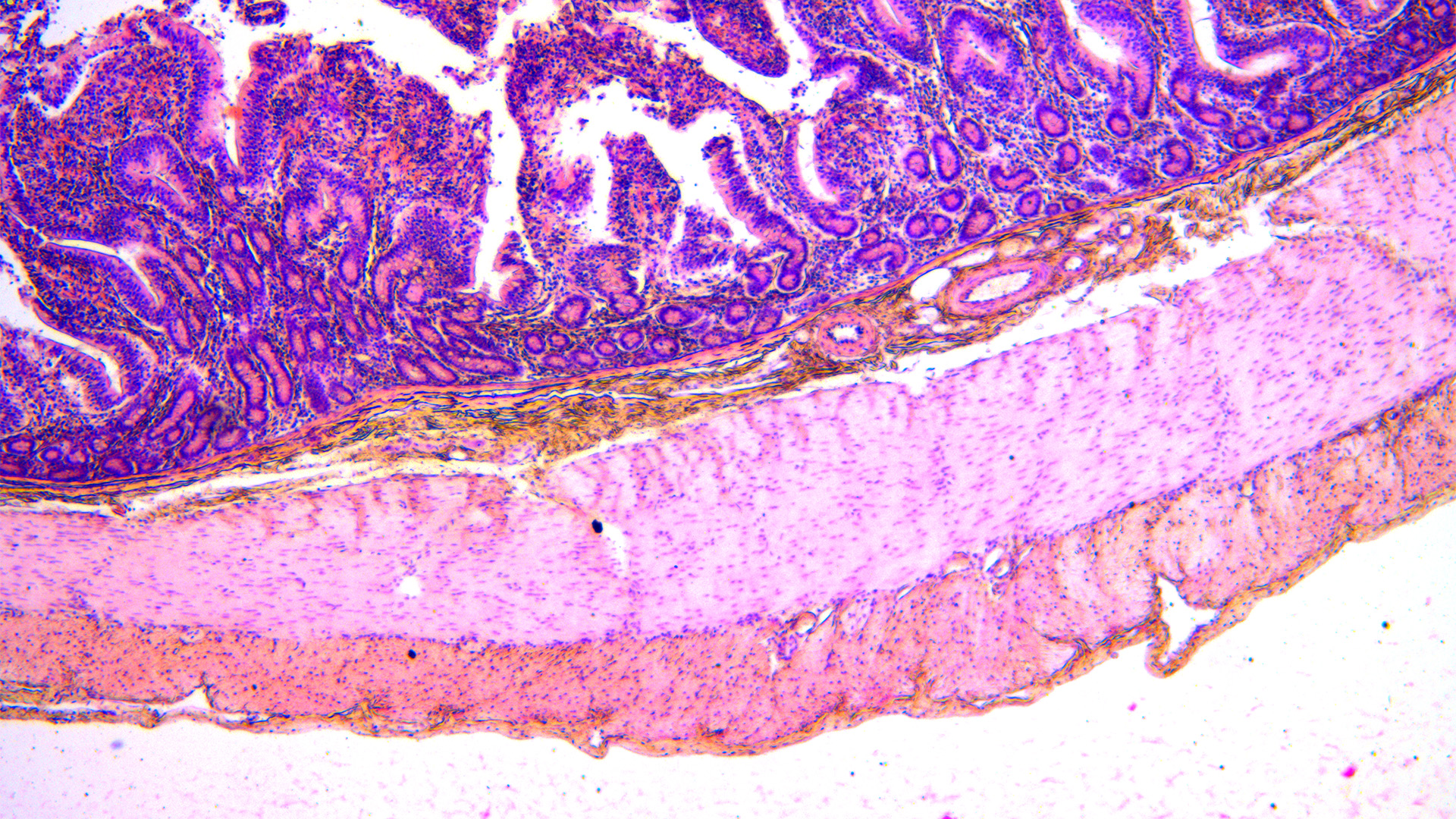 Image of a H&E-stained duodenum showing the boundary between the submucosal and mucosal regions, making it easy to distinguish the different cell types. 