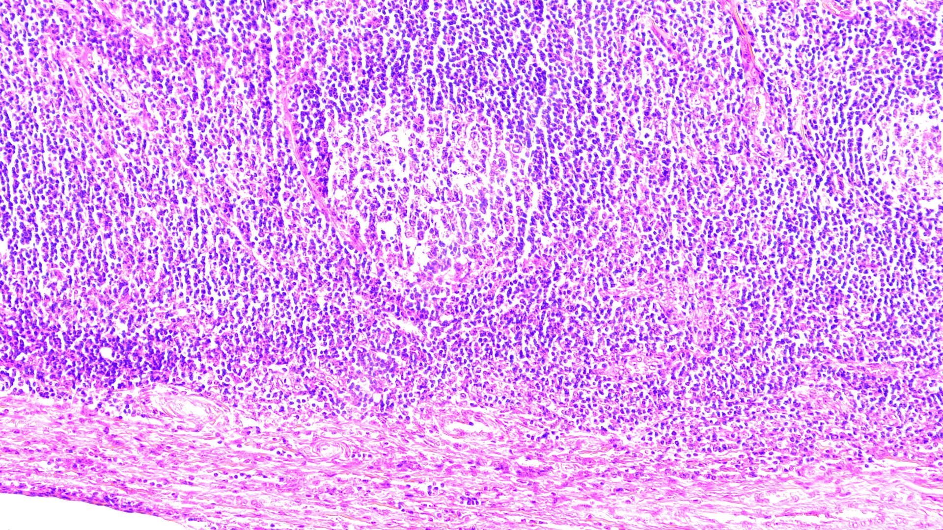 H&E staining image