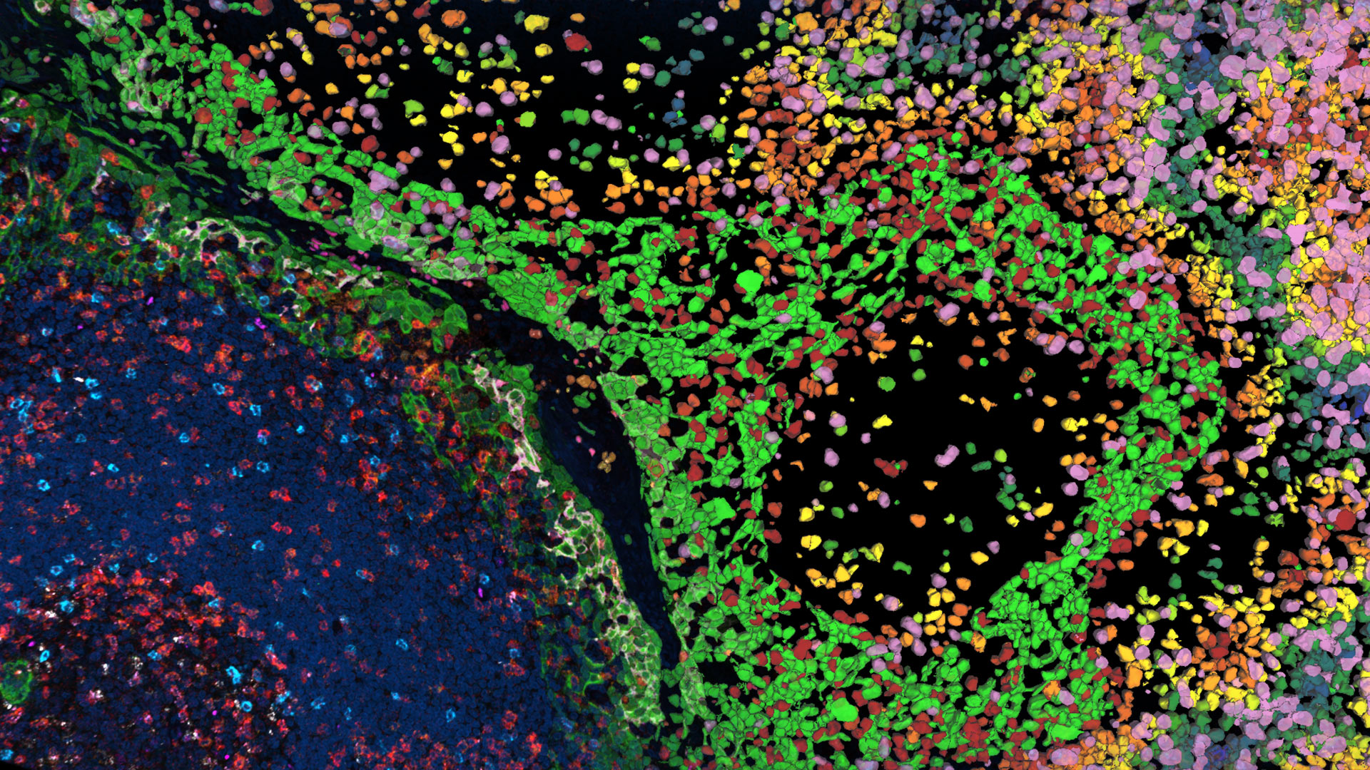 Multiplexed human tonsil tissue labeled with a panel of 8 OPAL dyes and DAPI acquired on a STELLARIS system, cell segmentation performed with Aivia 14.